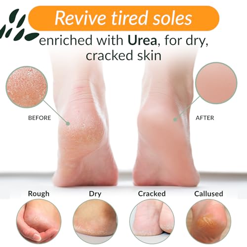 Tree to Tub Non-Greasy Foot Moisturizer for Dry Cracked Feet & Heels - Urea Cream with Shea and Cocoa Butter for Women &